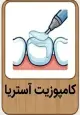 قیمت کامپوزیت دندان