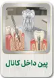 پین داخل کانال