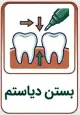 بستن دیاستم