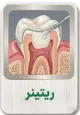 ریتینر
