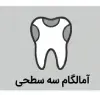 آمالگام سه سطحی