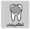 آمالگام بیلداپ